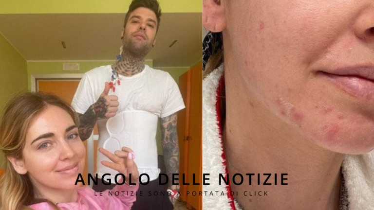 Fedez Chiara Ferragni